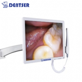 DentSer Ağız İçi Kamera Monitör ve Monitör Kolu Seti AK1-5